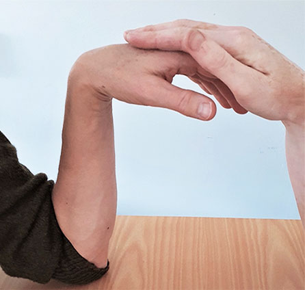 Karpaltunnelsyndrom, Phalens test